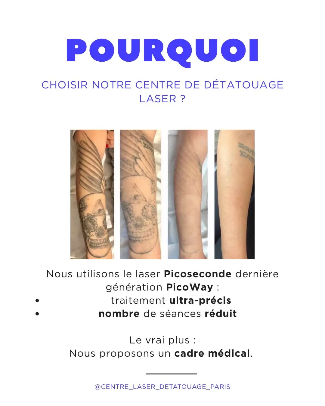 Poutquoi Picoseconde Technologie