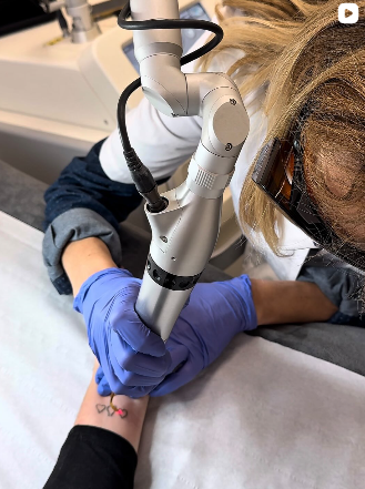 Centre détatouage à Paris 8e - 4e