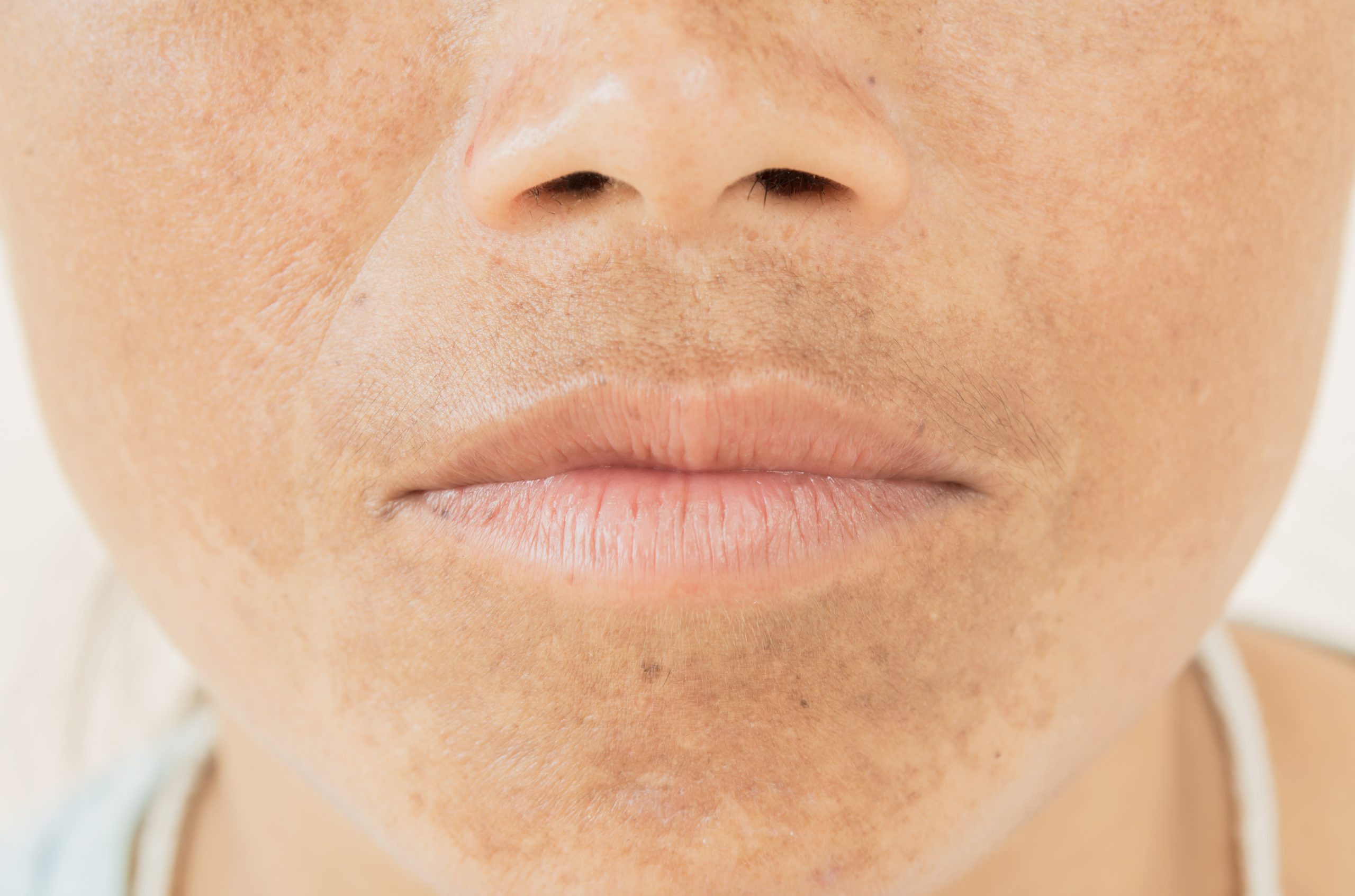 Picoseconde Laser Technologie à Paris 8e